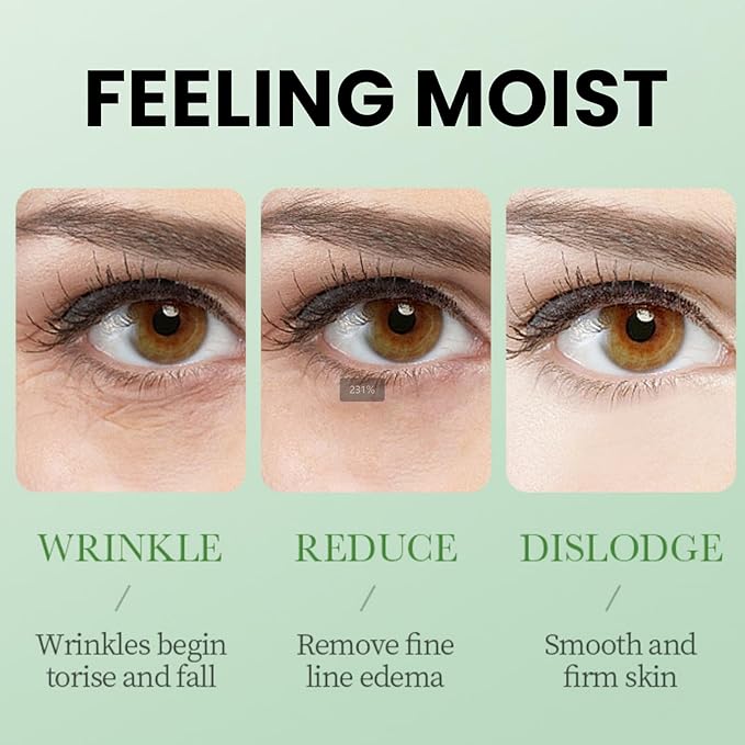 Under Eye Patches for Dark Circles, Puffy Eyes and Dark Circles, Under Eye Mask Dark Circles Under Eye Treatment, Aloe Vera, Moisturizing and Hydrating for Eye Bags, Puffy Eyes, Wrinkles, Fine Lines