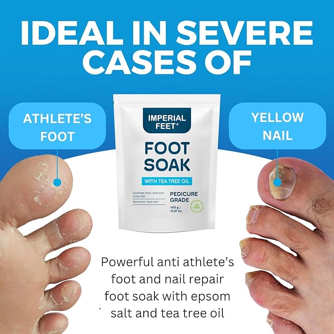 Epsom Salt Foot Soak w Tea Tree for Foot Bath (Pedicure Grade) - for Toenail Repair, Athletes Foot, Softens Calluses, Sore & Tired Feet, Nail Discoloration Foot Soak Salts, Smelly Foot Therapy16oz