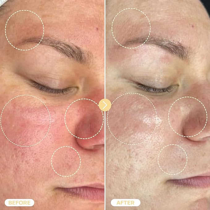 BASE LABORATORIES Hypochlorous Acid Spray for Face & Skin - Travel Size - Magic Facial Toner Spray & Cleaner - Skin Repair Solution helps reduce redness, acne - HOCL Molecule Spray 4oz (2 x 2oz) - 2PK