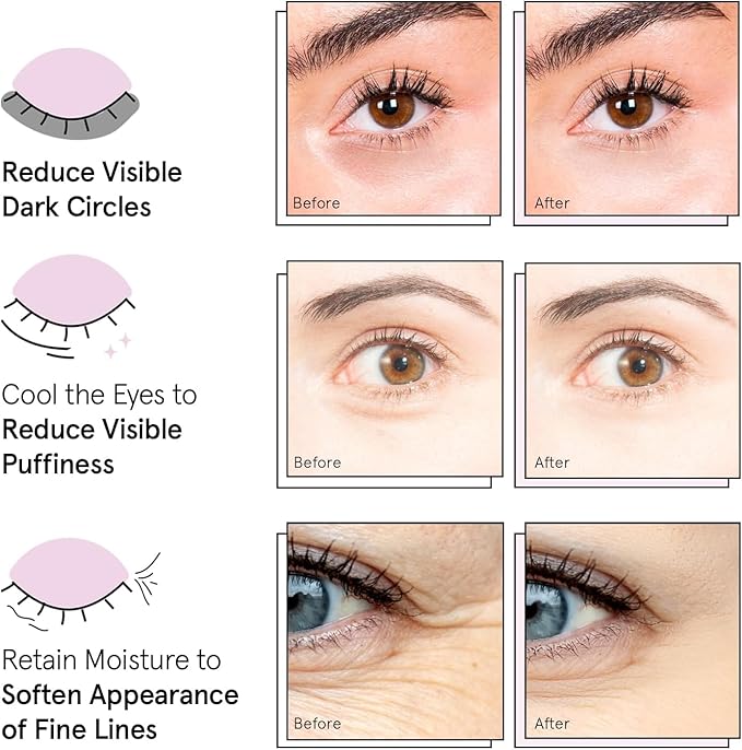 grace & stella Award Winning Under Eye Mask (Blue, 24 Pairs) Reduce Dark Circles, Puffy Eyes, Undereye Bags, Wrinkles, Gel Under Eye Patches, Birthday Gifts for Women - Vegan Cruelty-Free Self Care