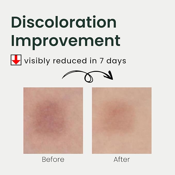 THE LAB BY BLANC DOUX Green Flavonoid 5.0 Serum & 2.0 Sunscreen Soothing Hydrating Moisturizing Facial Treament SPF 50 for Sensitive Acne-Prone Skin Korean Beauty Skincare