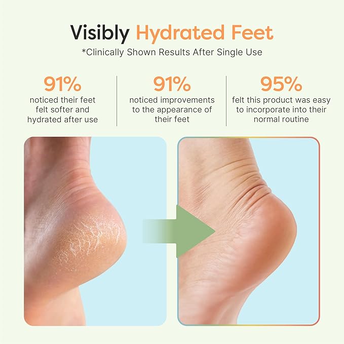 ZenToes Moisturizing Socks for Cracked Heel Treatment - Vitamin E, Olive Oil and Jojoba Oil Infused Heel Socks to Soften and Hydrate (Pink Strawberries, Regular)