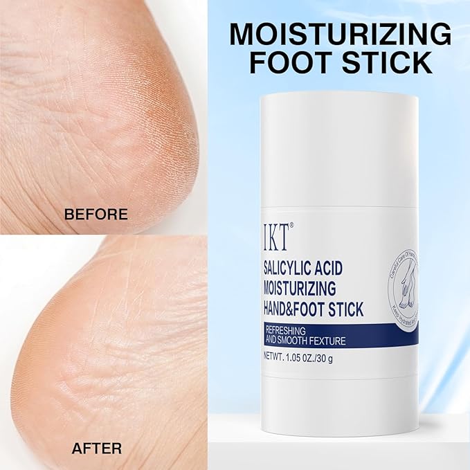 Professional Repair Heel Balm Stick for dry cracked feet treatment, intensive foot repair, moisturizes heels, deeply moisturizes and softens feet, refreshingly smooth non-greasy texture