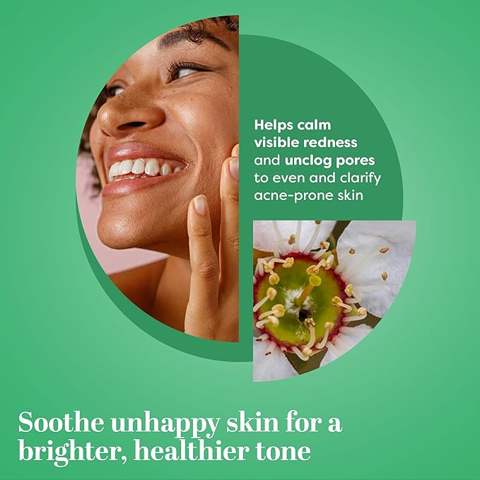 TruSkin Tea Tree Oil Acne Treatment for Face – Acne Serum – Improve the Appearance of Pores, Skin Tone for Smooth, Glowing Skin with Salicylic Acid, Vitamin C, Niacinamide & Retinol, 1 fl oz