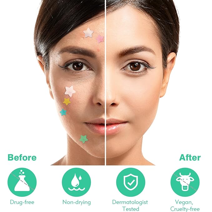Star Pimple Patches For Face 240 Counts Hydrocolloid Acne Patches with Tea Tree Oil Blemish Zit Patches For Face 3 Sizes Acne Patch Acne Dots Patches 6 colors Pink Yellow Blue Star Pimple Patches