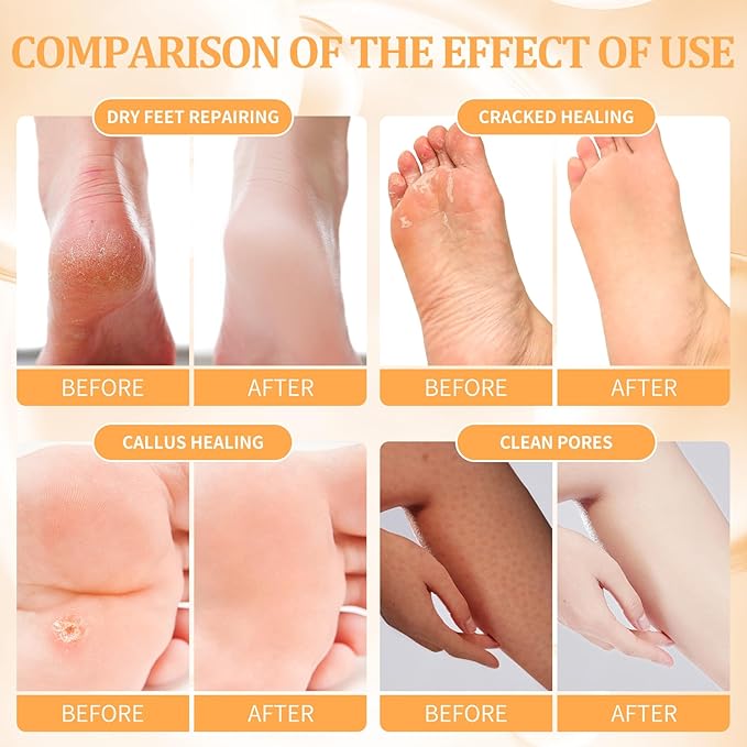 Pedicure Kit Foot Soak Set: Bubble Salt, Sugar Scrub, Massage Mask, Massage Lotion in a Box, 4 Step Foot Spa Kit for Dry Feet, Calluses and Tired Feet(1 Set Tropical Fruit)