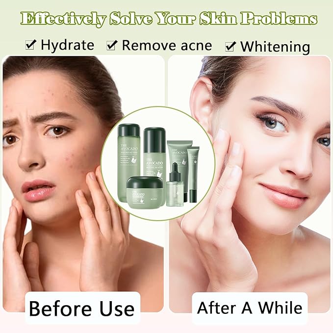 Avocado Skin Care Set for Women,6PCS Skincare Kits with Facial Cleanser, Toner, Serum, Lotion,Cream, Eye Cream, Moisturizing Korean Skincare Set,Anti-Aging Skin Care Set,Face Care Gift Set for Women