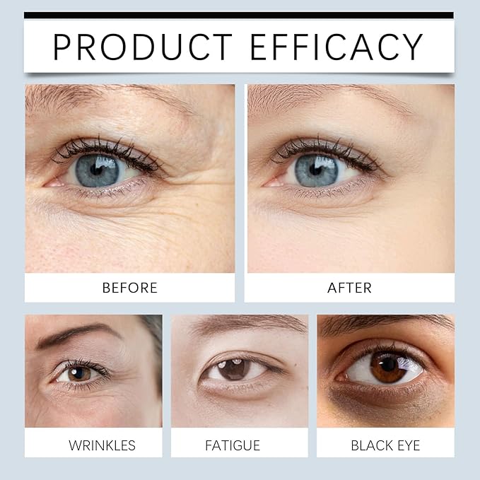 Anti Aging Wrinkle Remover For Face, Reduce Immediately Fade Fine Lines Around The Eyes, Eye Bags Firming Eye Cream Eye Essence, Moisturizing Eye Cream