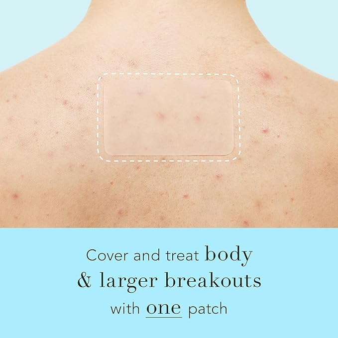 Rael Pimple Patches, Miracle XL Spot Control Cover - Hydrocolloid Acne Patch for Face, Zits & Blemish, Back and Body, Korean Skin Care, Vegan, Cruelty Free (6 Count)