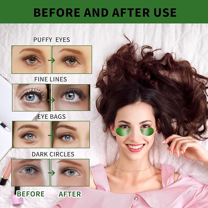 Under Eye Masks for Dark Circles and Puffiness 70PCS, Under Eye Patches for Puffy Eyes Treatment, Under Eye Gel Pads w/Seaweed, Aloe Vera, Peptides for Eye Bags Treatment, Eye Mask Patches Skincare