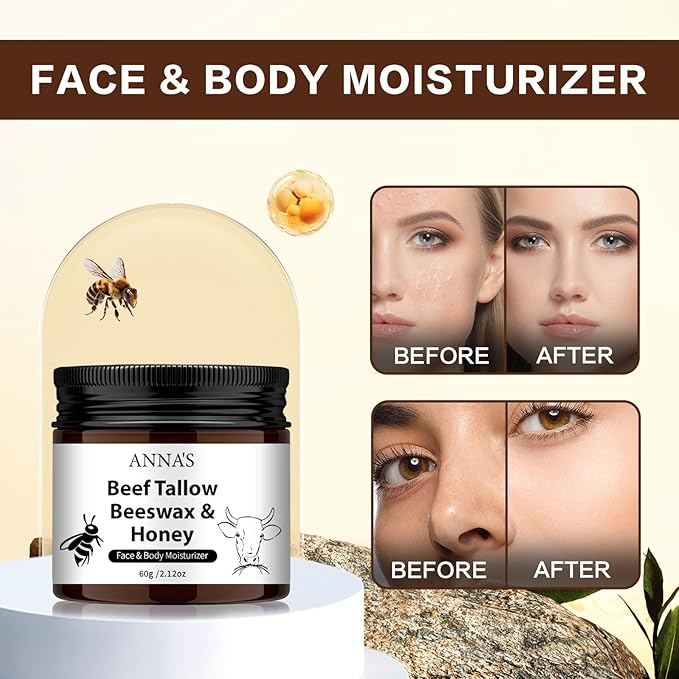 ANNA'S Beef Tallow and Honey Balm for Skin, All-Natural Moisturizer for Face and Body, Hydrating Grass-Fed Beef Tallow & Raw Wild Honey Blend (60g/2.120z)