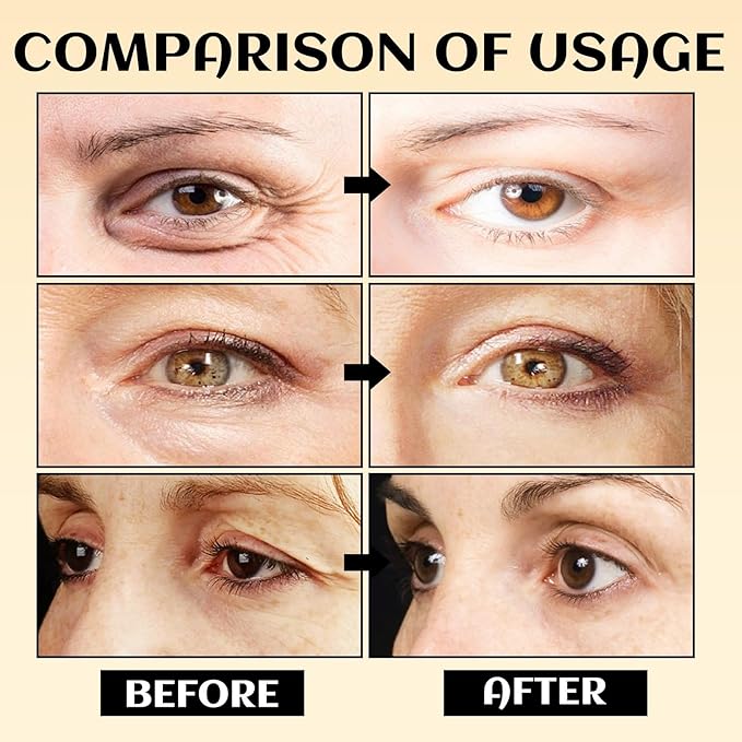 Eye Serum Stick, Stick For Under Eye Bags, Eyebalm,Deeply Moisturizes,Reduce Fine Lines (3pcs)