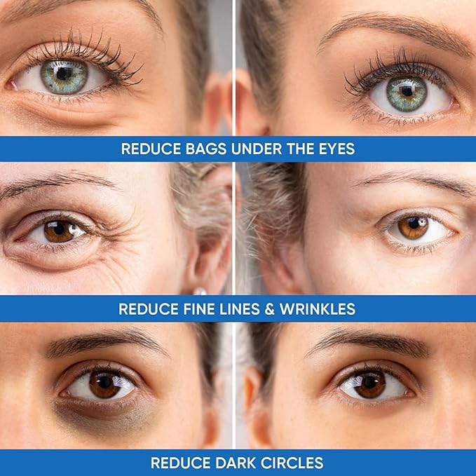 Under Eye Puffiness & Dark Circles Rapid Treatment- Instantly Reduces the Appearance of Puffy Eye Bags, Crow’s Feet, & Sagging Skin.