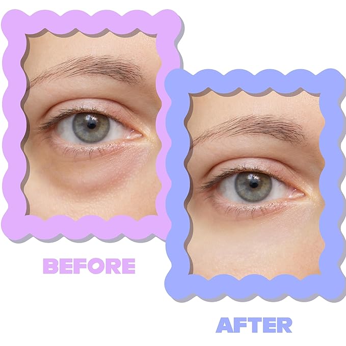 ULTIMATE HYDROGEL EYE MASK 28 Pairs Under Eye Patches, Rejuvenate Eye Area Reduce Dark Circles Puffiness, Tiredness Bags, Gel Pads Brightening, Plumps Fine Lines