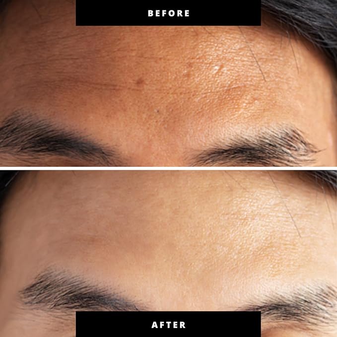 Red & Blue Light Therapy for Face and Neck, Beauty Wand with Dual Light and Infared Modes