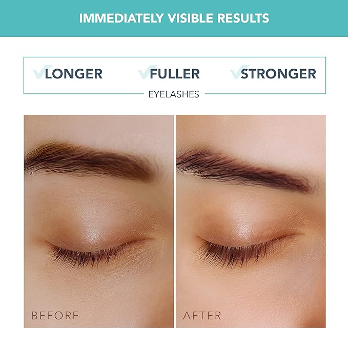 FOREO IRIS Eyelash Serum - Volume, Protection, Strength - Longer Lashes and Eyebrows - Concentrated Lash Serum for Eyebrow and Eyelash Growth- Phytokeratin, Arginine & HA - Fragrance Free - 0.15 fl.oz