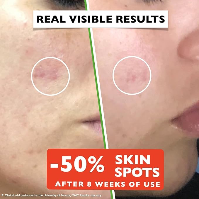 Vitamin C Serum For Face – Anti-Aging Facial Serum with Vitamin C, Hyaluronic Acid, Niacinamide, B5 & Vit E. Brightening Facial Essence for Dark Spots, Fine Lines, Wrinkles & Glowing Skin, 2 Fl Oz