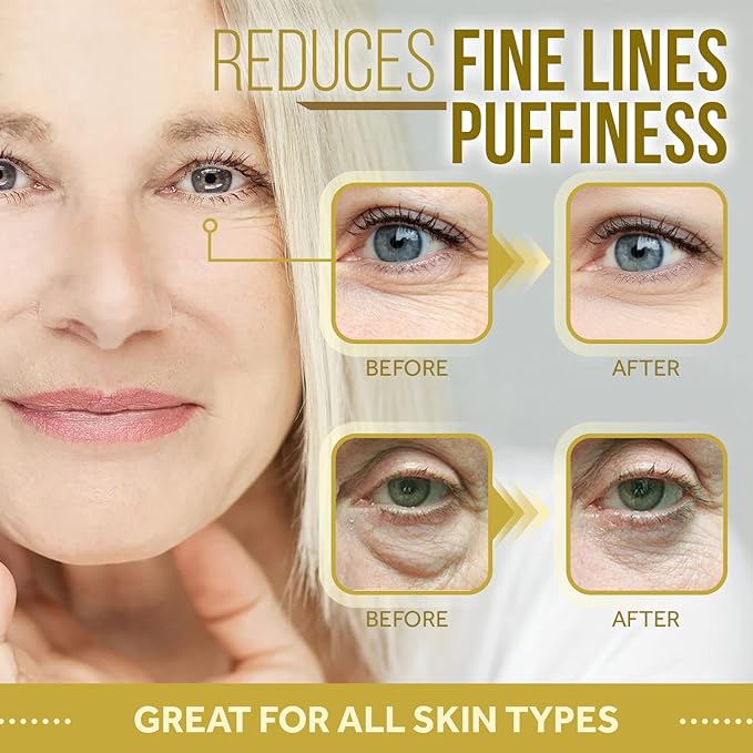 Forehead and Under Eye Wrinkle Patches for Face - Collagen, Hyaluronic Acid and Vitamin A Skin Pads - Forehead Line Remover Wrinkle Eye Patch Set - 26 Caviar Sachets