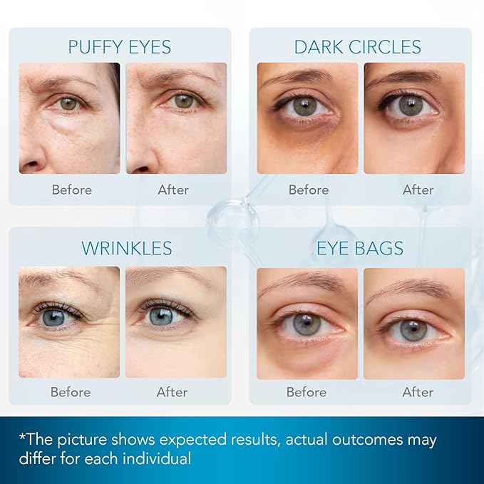 Under Eye Patches for Dark Circles: Under Eye Mask for Wrinkles - Eye Bags - Fine Lines - Puffy Eyes - Gel Mask - Amino Acid - Hydrolyzed Collagen - Anti Wrinkle Patches - Blue Eye Patches - 30 Pairs