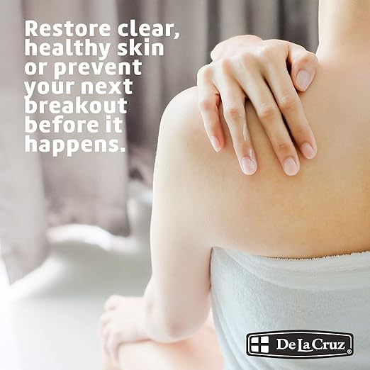 De La Cruz 10% Sulfur Ointment - Cystic Acne Treatment for Face and Body - Daily 10 Min Spot Treatment Mask - Safe and Effective Game Changing Hormonal Acne Treatment That Clears Up Pimples - 2.6 oz