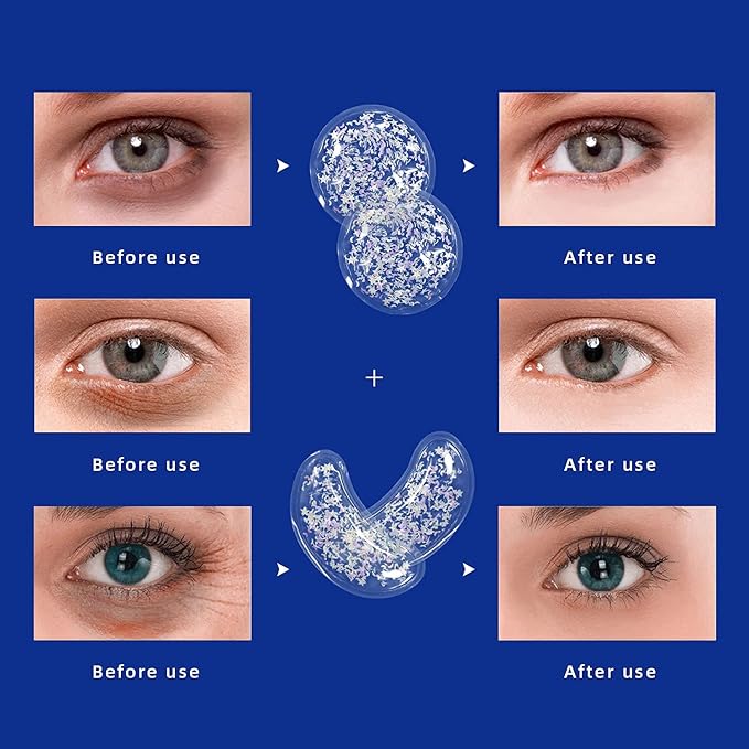 Gel Ice Pack Reusable Cooling Pads and Under Eye Patches, Hot & Cold Eye Treatment Pack for Redness and Pain Relief