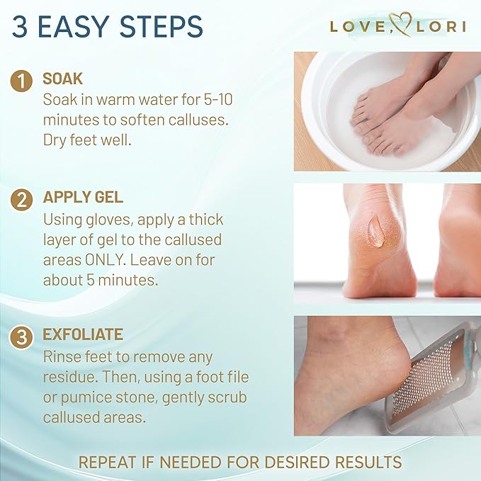 Callus Remover for Feet (Extra Strength) Professional Foot Scrubber Trimmer Dead Skin Callus Gel - Pedicure Tools for Feet Spa Essential, 6oz