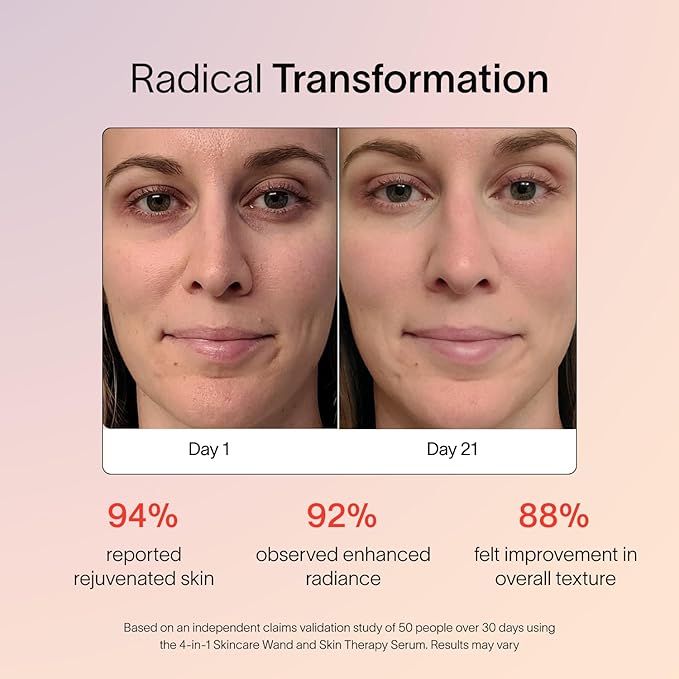 Solawave Skincare Wand & Serum – 4-in-1 Galvanic Current, Face Massager, & Red Light Therapy Wand – 1 Oz Activating Serum for Anti-Aging, Wrinkle Reduction, Face Lift & Hyperpigmentation Skin Care