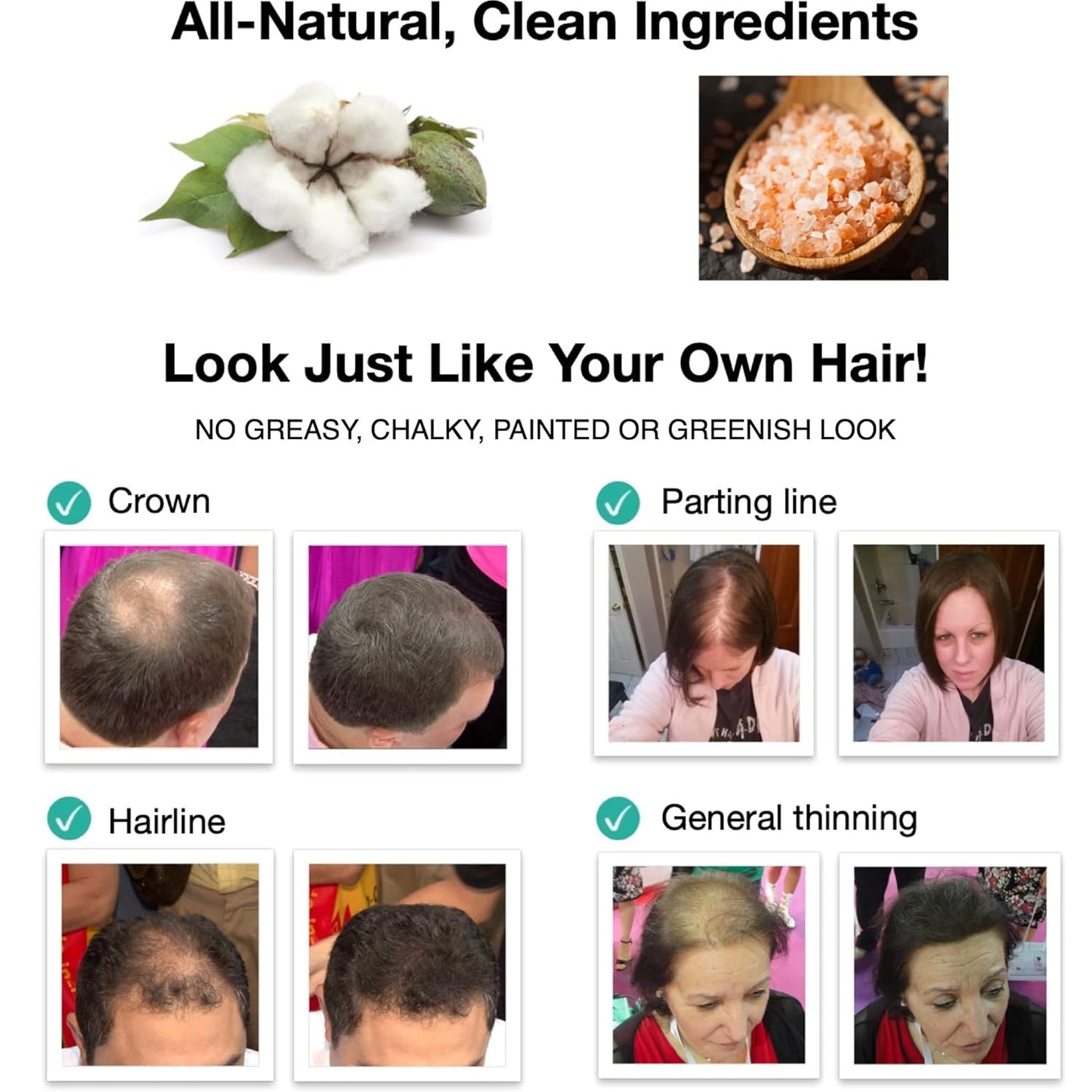 Caboki Hair Loss Concealer. All-Natural, Plant-Based Hair Building Fiber. Covers Bald Spot and Thinning Hair. Make Thin Hair Look 10X Fuller Instantly.(30G, 90-Day Supply). Light Auburn