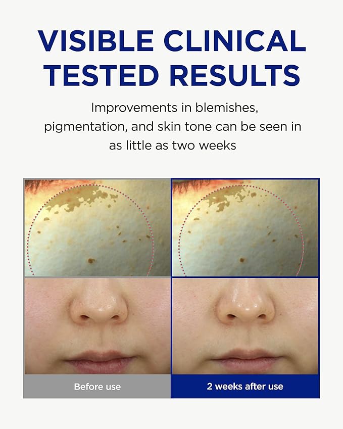 CKD Vita C Teca Blemish Shot Face Gel Mask with Vitamin C & Centella Asiatica (5ea) - Korean Hydrogel Mask for Glass Glow Skin, Dark Spot Treatment, and Blemish Treatment. Korean Skincare Routine