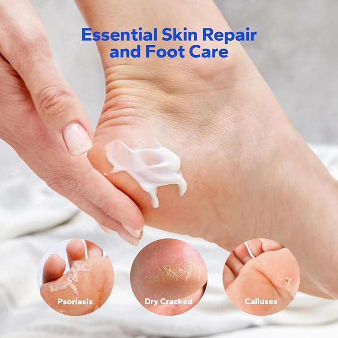 Urea Cream 40% + Salicylic Acid 2%, Urea Foot Cream with Jojoba Oil, Avocado Oil, and Aloe Vera for Foot Dry Cracked Heels, Knees, Elbows, Hands Repair Treatment, Deep Moisturizes Skin