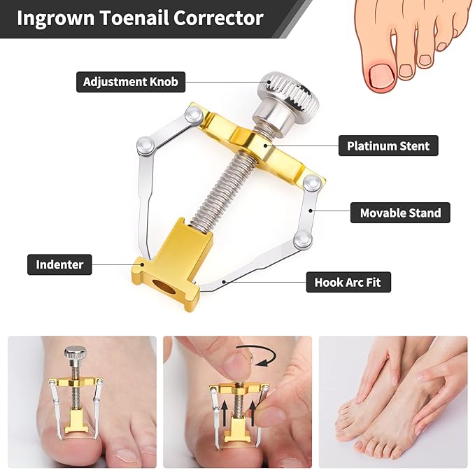 Segbeauty 10pcs Ingrown Toenail Removal Kit, Nail Clipper Toenail Clipper Manicure Pedicure Kit, Professional High Manganese Steel Blade Ingrown Toenail Corrector Tool Set for Remove Cuticle Callus