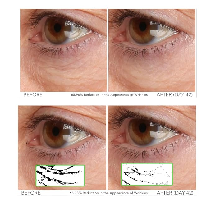 Serious Skincare - Beyond Intensive Vitamin C Serum for Face & Neck - 60 Day Facial Treatment to Brighten & Revive Glow - Visibly Smooth Lines, Wrinkles and Pores - AM & PM 2 Piece Skin Care Set