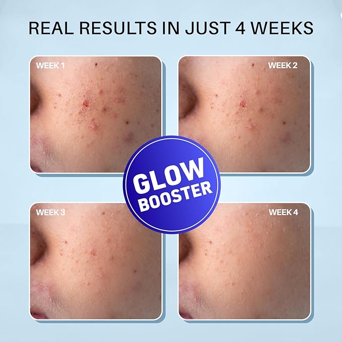 Night Cream (50g) | With Niacinamide & Alpha Arbutin | Face Moisturizer | 1.76 Oz