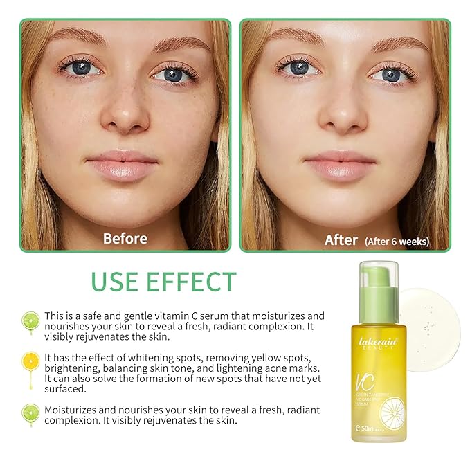 NICEFACE Green Tangerine Vitamin C Face Serum - Facial Serum with Vitamin C, Niacinamide & More - Brightening Serum for Dark Spots, Balancing Skin Tone, and Lightening Acne Marks (50ml), transparent