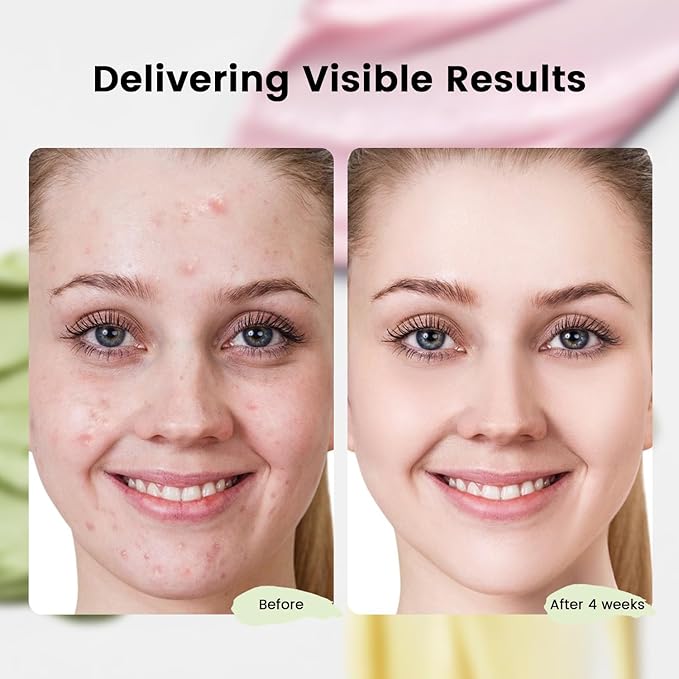 Turmeric Clay Mask, Rose Face Mask & Green Tea Mud Mask 12 PCS - Spa Facial Mask Set Gift for Women & Men, Skin Care Set for Deep Cleansing, Moisturizing, and Refining Pores