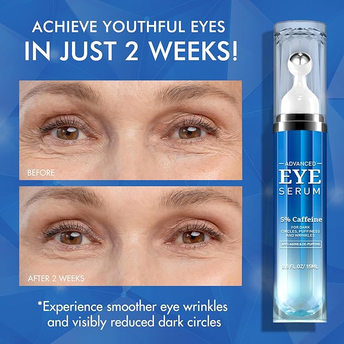 Eye Serum for Dark Circles and Puffiness - 5% Caffeine Under Eye Cream Anti Aging, with Retinol Hyaluronic Acid Niacinamide, Eye Serum for Eye Bags with 360° Eye Roller Ball for Women & Men
