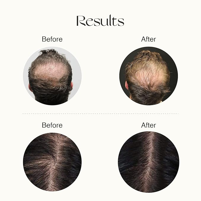 Nourish Mantra Eyebrow Growth Serum 10 ml and Advanced Hair Regrowth Serum 50ml