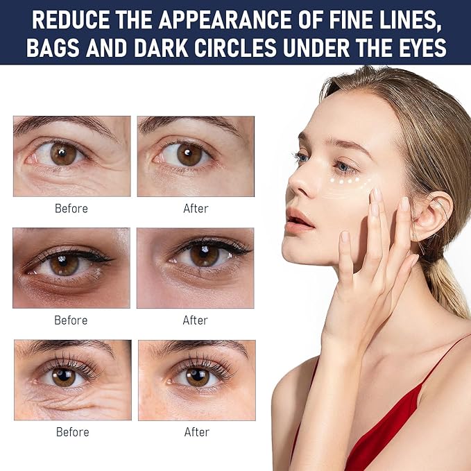 Rapid Reduction Eye Serum, Anti Aging Serum Visibly Reduces Under-Eye Bags, Sunlit Rose- Satin Finish, Nourishing Eye Serum, Suitable For All Skin Type(2PCS)