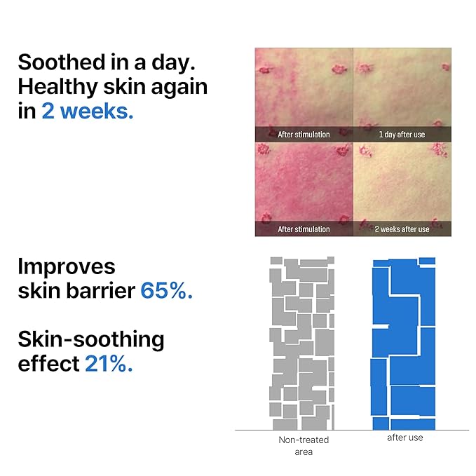 SOME BY MI Beta-Panthenol Repair Serum – 1.01oz, 30ml – Korean Hydrating Hyaluronic Acid Serum for Face – Daily Barrier Repair & Soothing Formula with Beta-Sitosterol & Panthenol – Korean Skin Care