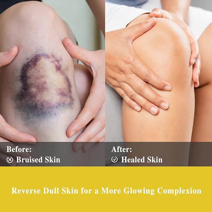 Helichrysum Essential Oil, MAYJAM Pure Essential Oils for Diffusers, 3.38FL.OZ/100ML Large Volume Helichrysum Oil with Premium Glass Dropper