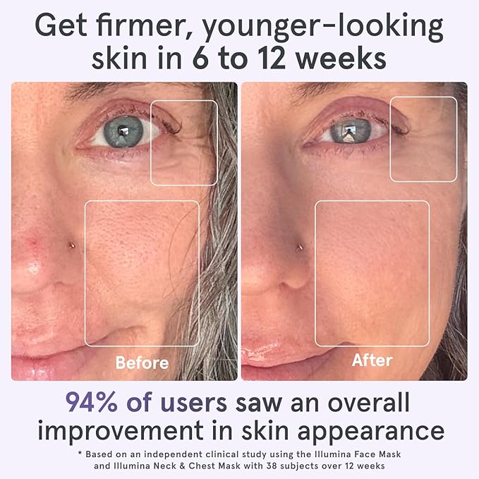 iRestore LED Face Mask Light Therapy | Blue, Infrared & Red Light Therapy for Face | Illumina Skincare Device Facemask - Youthful Radiant Skin with Reduced Wrinkles, Fine Lines | Contour | 360 LEDs