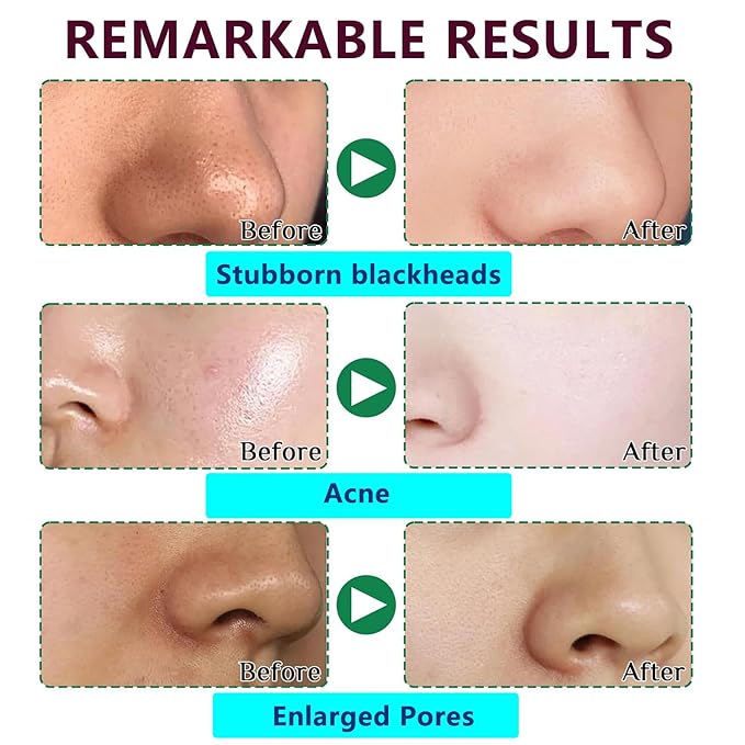 Blackhead Pore Strips, Black Head Remover Strips for face, Deep Cleansing Nose Blackhead Strips With Instant Pore Unclogging, Oil-Free, for Women & Men