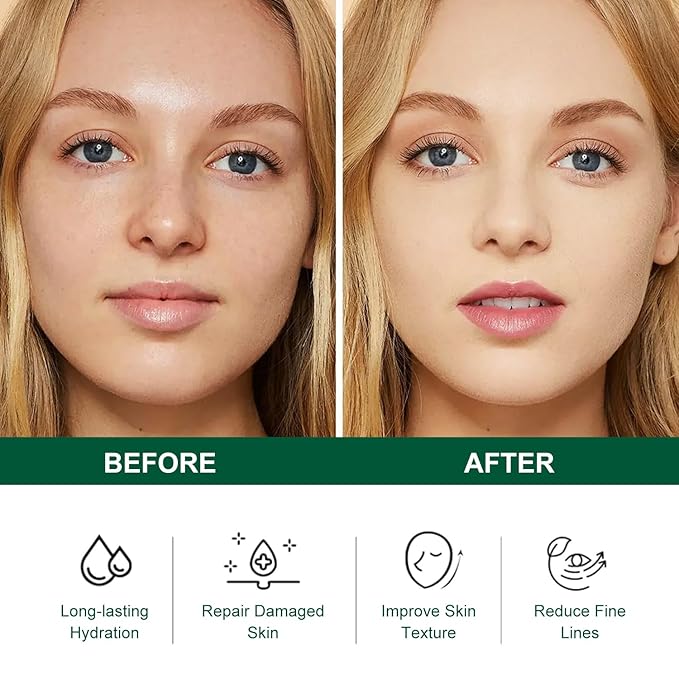 Skincare Mini Kit, Tea Tree Skin Care Sets & Kits, Acne Skincare Set Gifts, Anti Acne Facial Kit Gifts for Women,Cleanser, Toner, Serum, Cream,Oil Control Facial Kit, Airplane Friendly Sizes