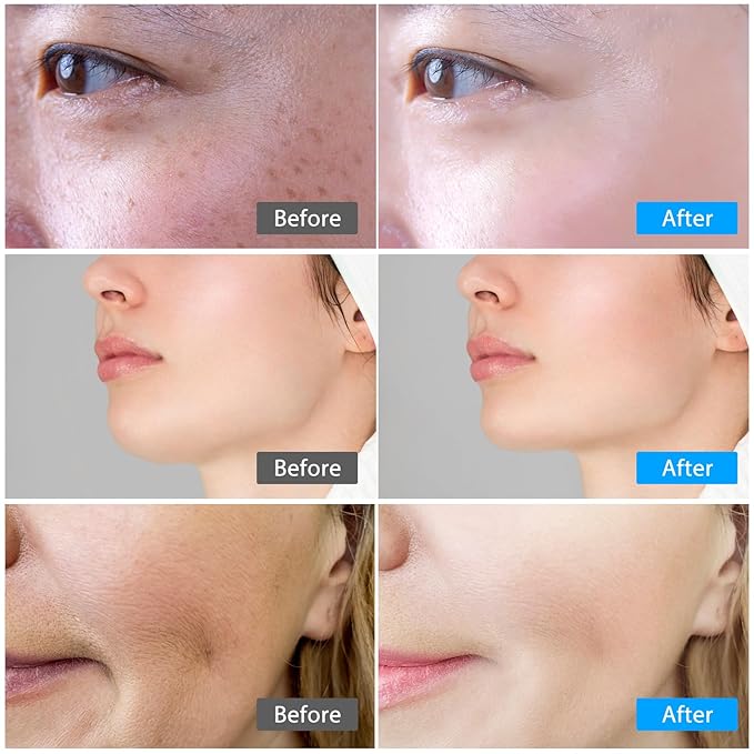 Red light therapy for face,Facial Massager,skin Care Tool,for Anti-Aging, at home,Lifting and Tightening Sagging Skin (Pearl White)