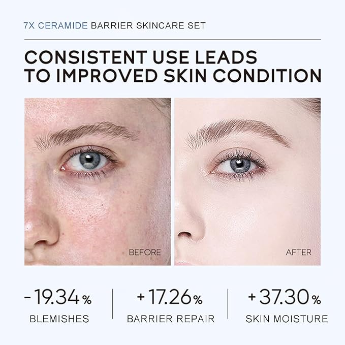 Skincare Set Ceramide Skincare Gifts for Teen Girls Strengthen Skin Barrier, Beauty Gift Sets Skin Care Kits, Travel Essentials, Facial Kit for Women & Girls Hydrating, Anti-Aging Skin