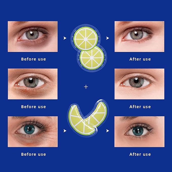 Gel Ice Pack Reusable Cooling Eye Pads and Under Patches,Eye Hot Cold Treatment for Redness,Pain Relief Relax