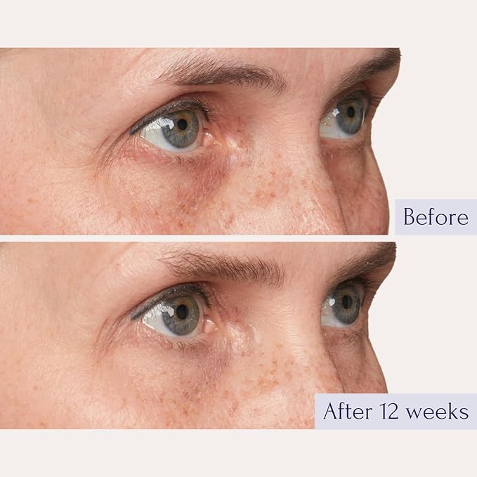 Tru Alchemy Eye Elixir Cooling Eye Treatment Cream - Dark Circle Eye Cream for Puffiness and Bags Under Eyes - Caffeine, Hyaluronic Acid, Vitamin C