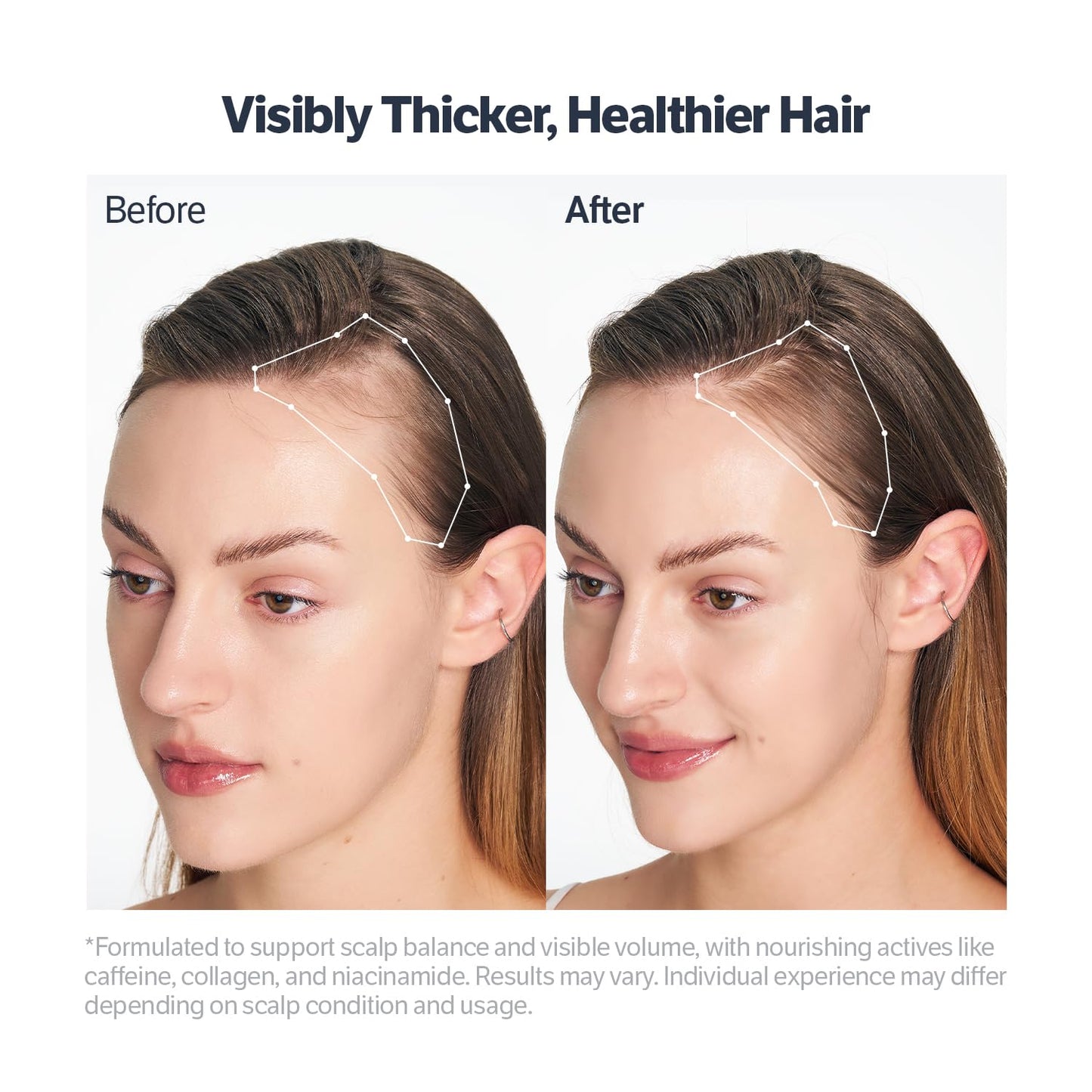 SUNGBOON EDITOR Deep Collagen Retinol Power Boosting Scalp Serum | Roll On Hair Growth, Hair Thickening Serum, Itchy & Dry Scalp Treatment, Caffeine, Biotin, Rosemary – Korean Hair Care, 0.5 fl oz