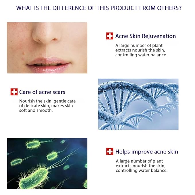 BIOAQUA PURESKIN - Acne & Rejuvenation Mask Sheet Treatment Face Rejuvenation Effective Removal Hamamelis Extract Nourishing Of (PACK OF 4 Mask Sheets = 4 x 30g)