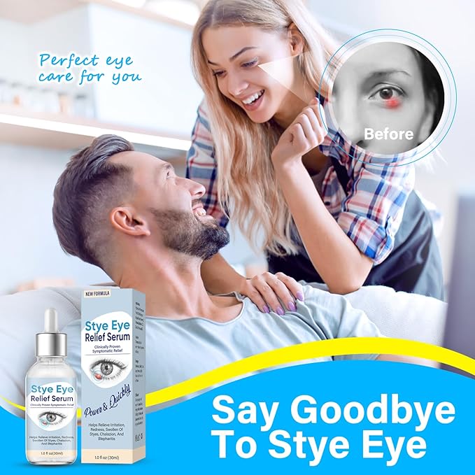 Stye Eye Treatment, Natural Stye Treatment Serum for Styes Chalazion and Blepharitis, Mild & Fast Relief